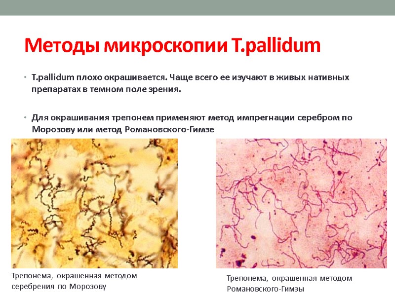Методы микроскопии T.pallidum  T.pallidum плохо окрашивается. Чаще всего ее изучают в живых нативных